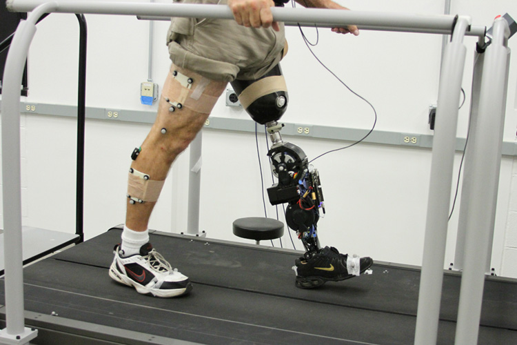 schieten kubiek Alarmerend Alumnus' Design of Powered Prosthetic Leg Aims To Give Amputees More  Control - News Center | The University of Texas at Dallas